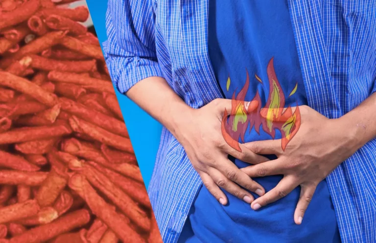 Can Takis Burn a Hole in Your Stomach? Yes...!