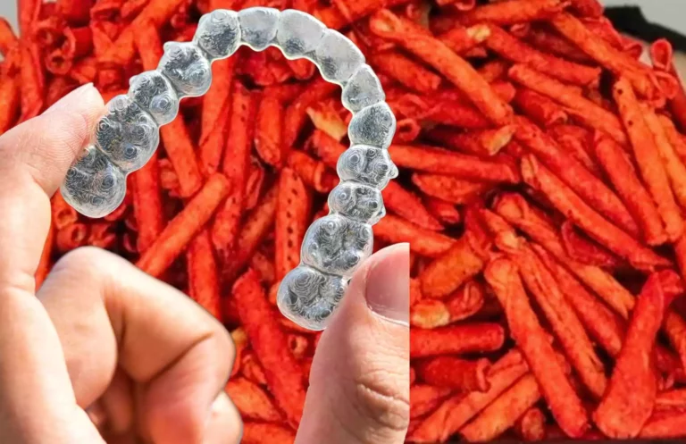 Top 3 Reasons Why You Shouldn’t Eat Takis with Braces? 
