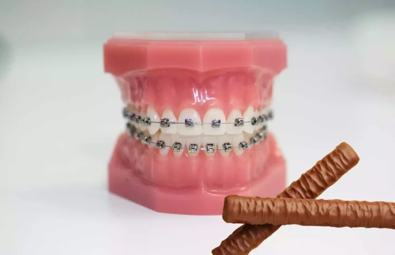 can you eat twix with braces? Not so often