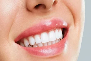 11 Ways Takis Can Harm Your Teeth and Oral Health